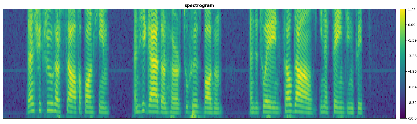 Spectrogram