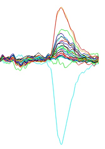 Stacked EEG